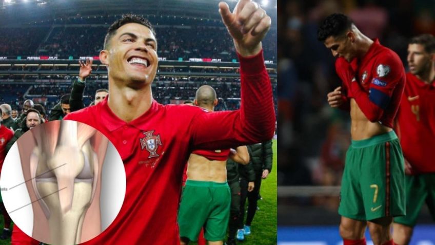 ¿Qué es la tendinosis? Lesión que a Cristiano Ronaldo mete miedo previo a Qatar 2022