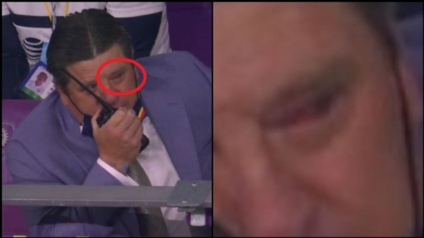 Así le quedó el ojo a Miguel Herrera tras pleito con auxiliar de LAFC (FOTO)