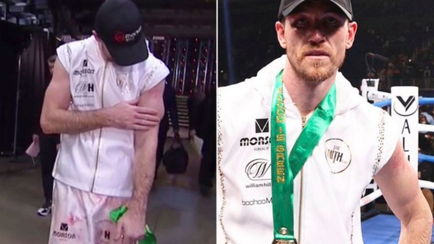 Callum Smith sufre brutal lesión tras paliza propinada por Canelo Álvarez