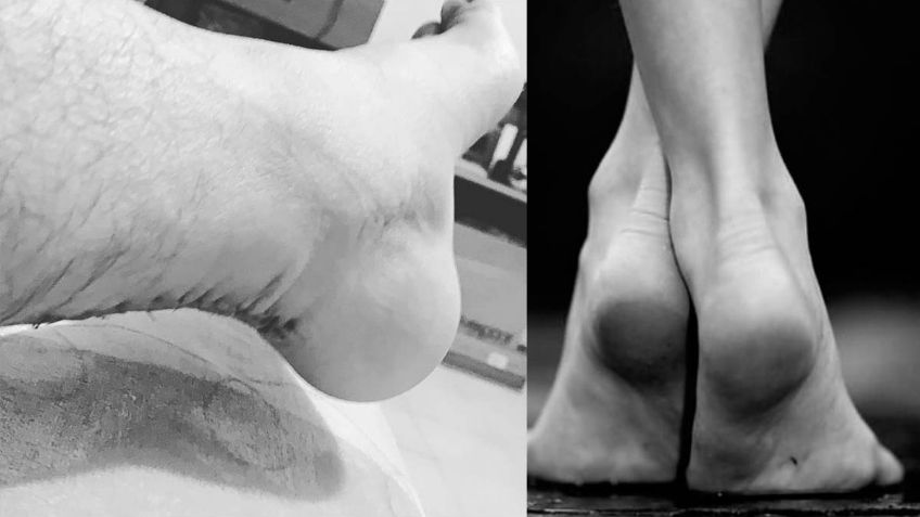 5 ejercicios para fortalecer el Talón de Aquiles y evitar lesiones graves