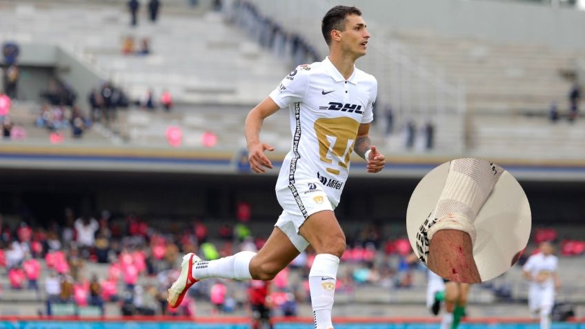 ¿Y el VAR? Así quedó la pierna de Juan Ignacio Dinenno tras el Pumas vs Atlas