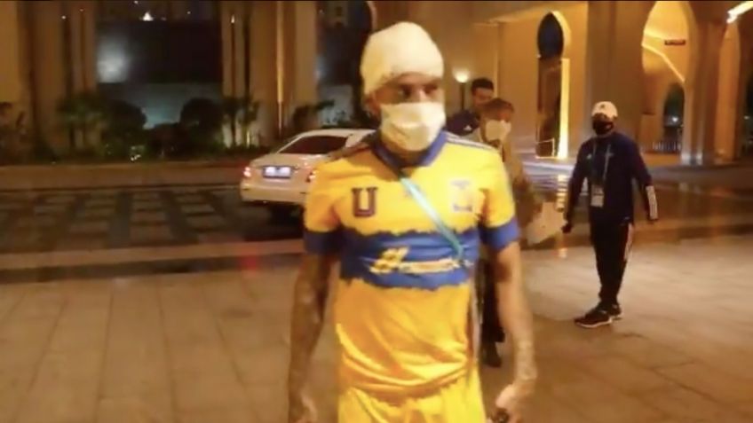 Tigres emite reporte médico de Javier Aquino tras brutal choque de cabezas