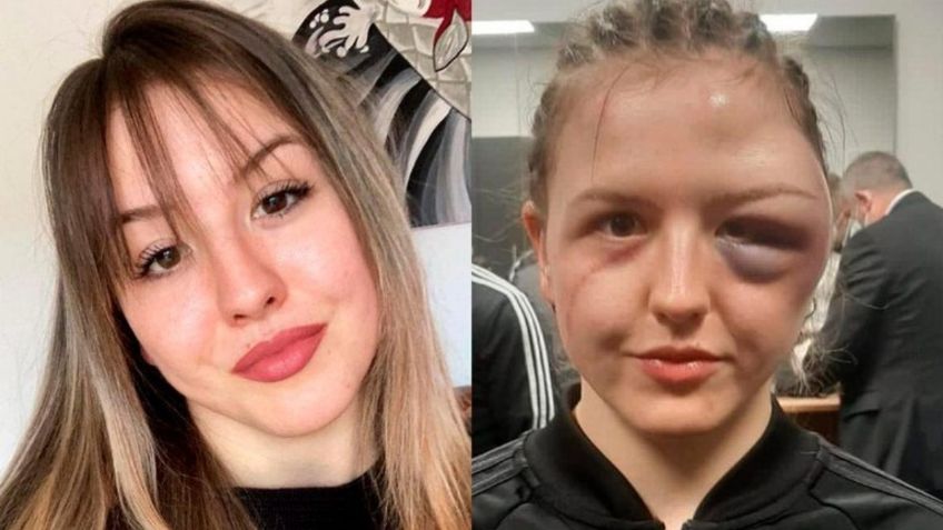 Boxeadora termina con rostro desfigurado tras choque de cabezas en pelea (VIDEO)