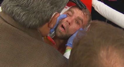 Billy Joe Saunders: Así se ve la fractura que le causó Canelo y que puede retirarlo