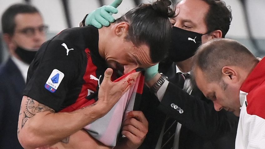 Zlatan Ibrahimovic sufre LESIÓN que pone en riesgo presencia en Eurocopa