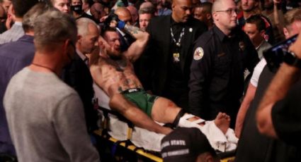 Conor McGregor hace dura acusación tras fractura que pone en riesgo su carrera