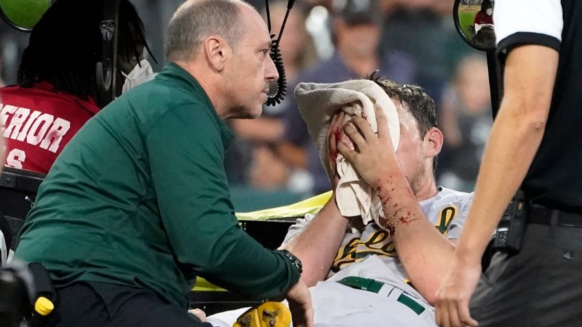 Tremendo pelotazo en el rostro deja tendido a lanzador en Grandes Ligas (VIDEO)