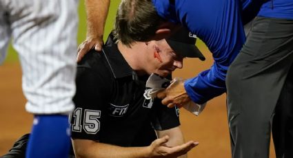 MLB: Umpire recibe duro pelotazo en la cara en el Cardinals vs Mets (VIDEO)