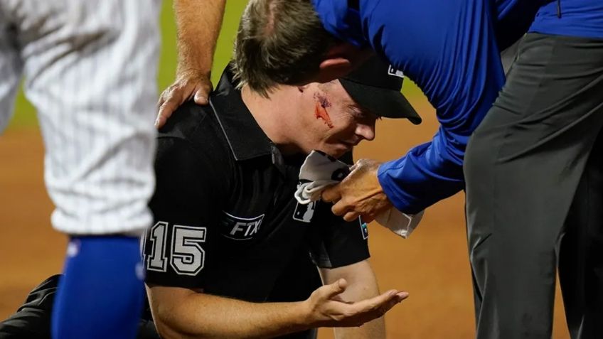 MLB: Umpire recibe duro pelotazo en la cara en el Cardinals vs Mets (VIDEO)