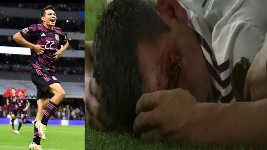 El miedo del Chucky Lozano: Revela terror que vivió tras su lesión en el ojo