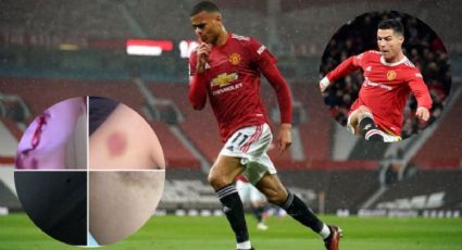 Escándalo en el Manchester United; Acusan a delantero por agredir fisicamente a su novia