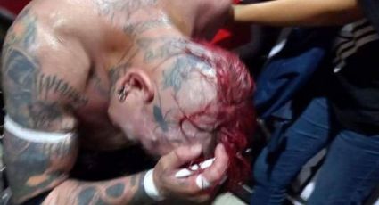 VIDEO VIRAL: Luchador Pagano muestra cómo le suturan una herida en la cabeza