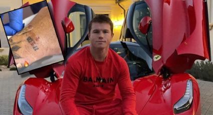 Canelo Álvarez mostró las huellas de su operación y cómo ruge su nuevo auto