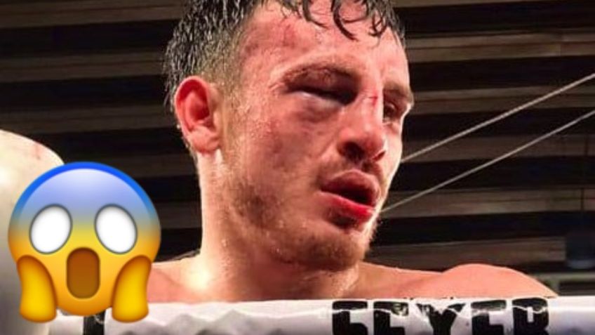 Los MEMES noquean a Omar Chávez tras derrota contra Rafael Amarillas ¿Se retirará?