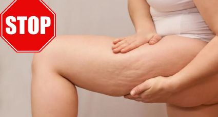 ¿Qué ejercicios ayudan a eliminar la CELULITIS de las piernas?