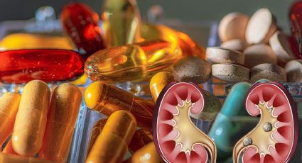 ¡CUIDADO! La SÚPER VITAMINA que si se consume en EXCESO se hacen PIEDRAS EN LOS RIÑONES