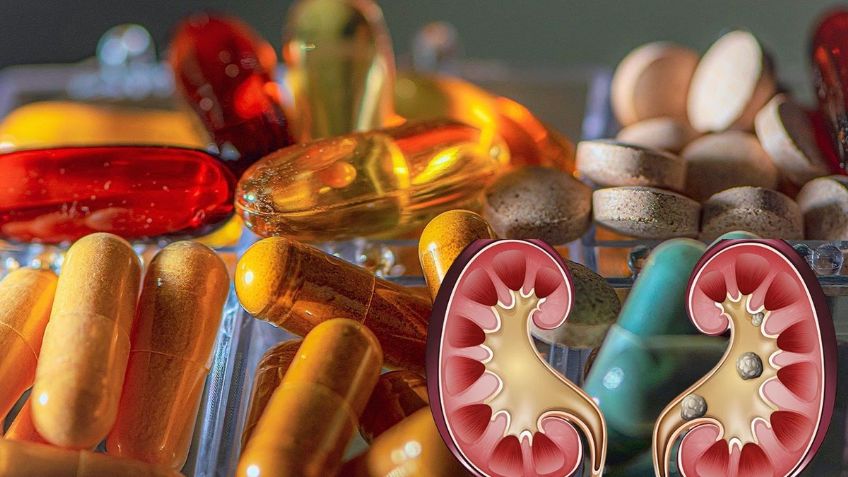 ¡CUIDADO! La SÚPER VITAMINA que si se consume en EXCESO se hacen PIEDRAS EN LOS RIÑONES