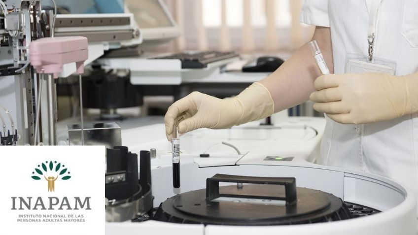 Credencial INAPAM: ¿Cuáles son los LABORATORIOS que dan DESCUENTO a adultos mayores?