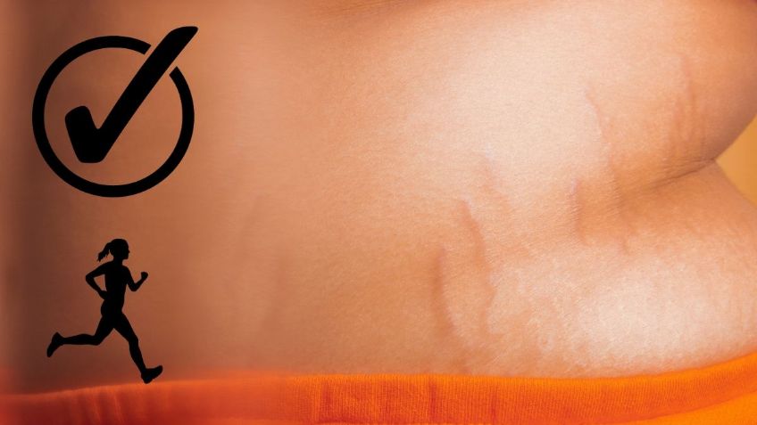 Estos son los mejores EJERCICIOS para eliminar las ESTRÍAS de tu cuerpo