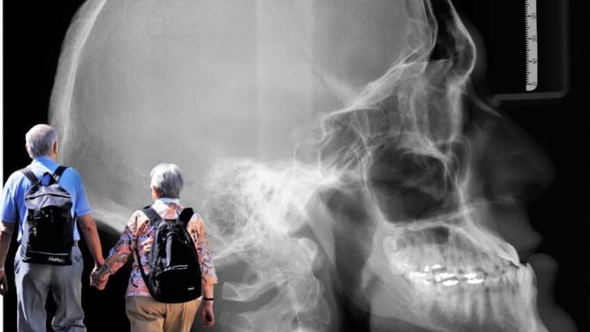 ¿Necesitas una RADIOGRAFÍA? Estos centros especializados dan DESCUENTO | Credencial INAPAM