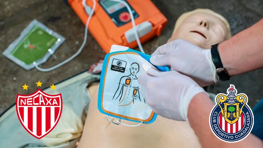 ¿Qué es el desfribilador, aparato que le SALVÓ la VIDA a un AFICIONADO en el Chivas vs Necaxa?