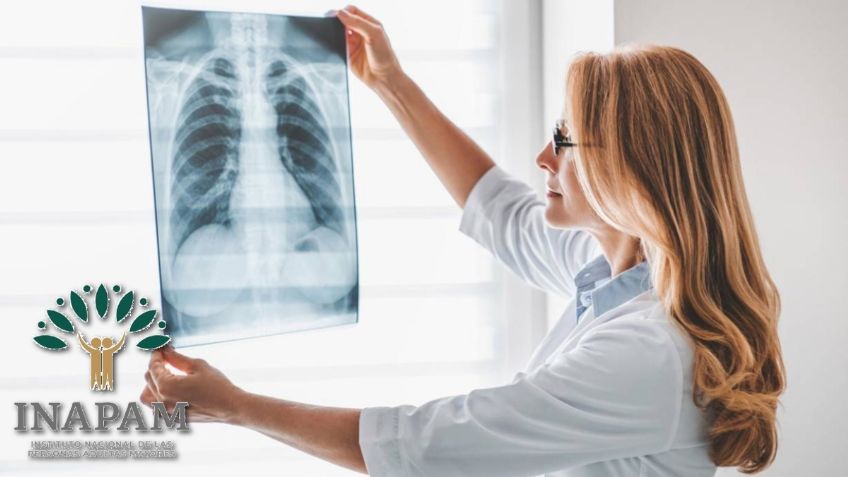 Credencial INAPAM: centros de RAYOS X que dan DESCUENTO a adultos mayores