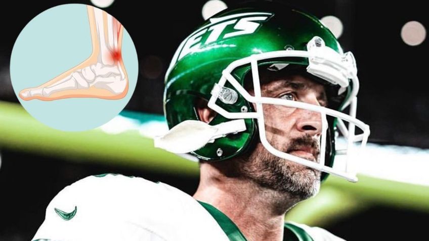 NFL: ¿En cuánto tiempo podrá regresar Aaron Rodgers tras haberse desgarrado el TENDÓN DE AQUILES?