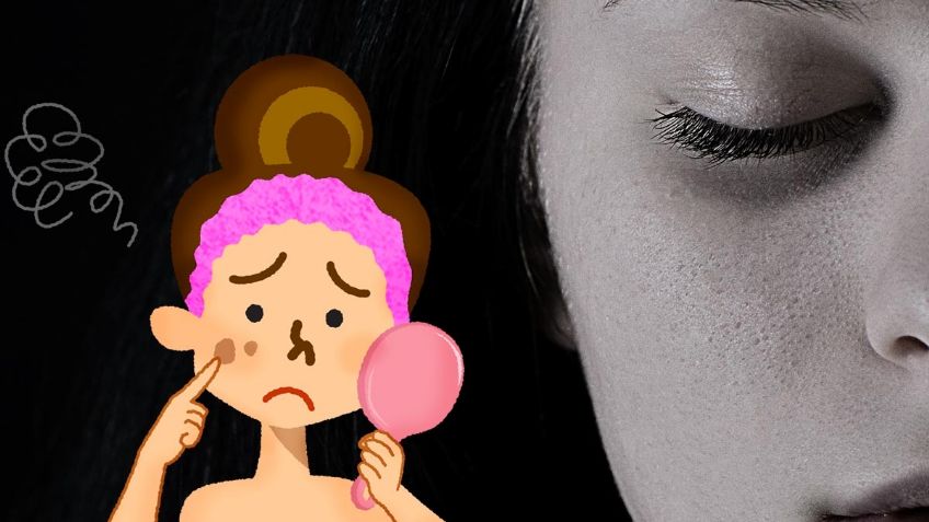 3 remedios caseros para evitar las MANCHAS de edad | Tips y recomendaciones