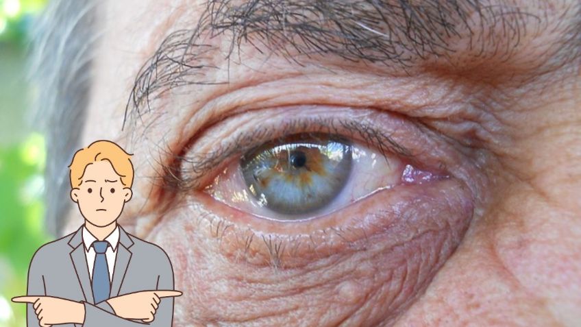 ¿Tienes arrugas en los ojos? Sigue estos 8 remedios y elimínalas para siempre