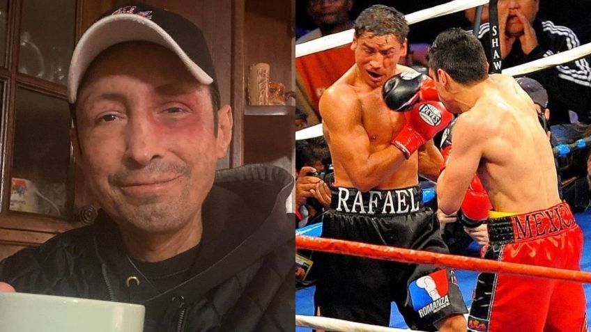 Israel Vázquez recibe duro pronóstico tras ser diagnosticado con sarcoma: "Le quedan 6 meses"