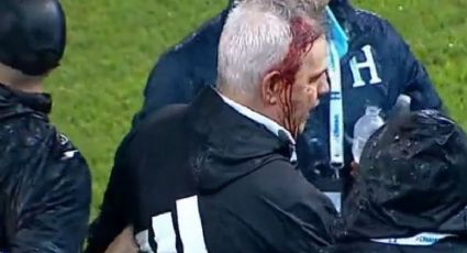 Javier Aguirre rompe el silencio tras golpe que le abrió la cabeza al terminar juego contra Honduras