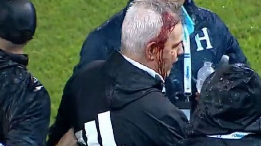 Javier Aguirre rompe el silencio tras golpe que le abrió la cabeza al terminar juego contra Honduras