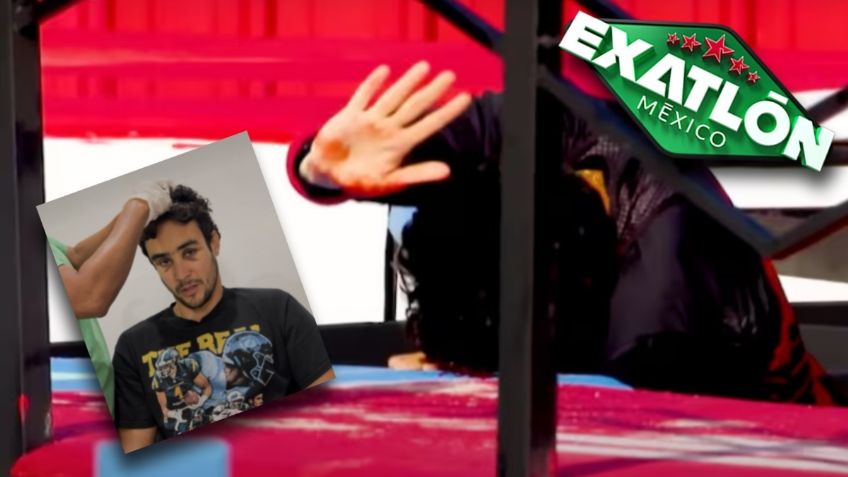 Exatlón México: Humberto Noriega revela el difícil proceso médico que lleva tras su terrible golpe