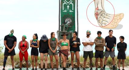 Survivor México: Spoilers revelan que participante sufre TRÁGICA fractura en el pie y queda eliminada