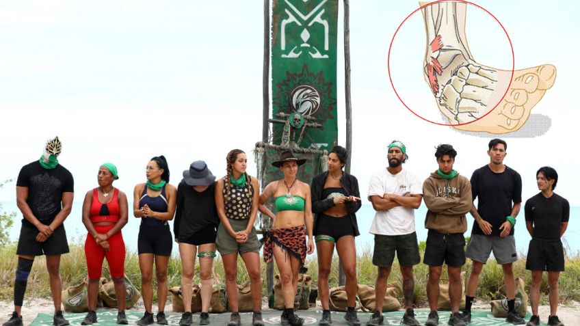 Survivor México: Spoilers revelan que participante sufre TRÁGICA fractura en el pie y queda eliminada