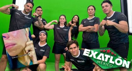 Diana Núñez del Exatlón México muestra en VIDEO los golpes que su expareja le dejó