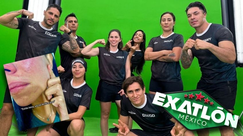 Diana Núñez del Exatlón México muestra en VIDEO los golpes que su expareja le dejó