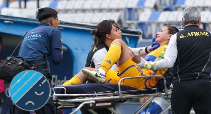 Así fue la IMPACTANTE lesión que sufrió Nayeli Rangel de Tigres Femenil en la cara | VIDEO