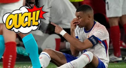 Así luce la nariz rota de Mbappé luego de recibir un fuerte golpe en la Eurocopa 2024