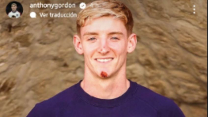 Estrella de Inglaterra sufre aparatoso accidente antes de jugar los Octavos en la Eurocopa 2024