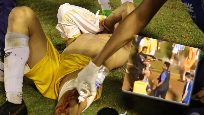 Policía le dispara a portero en pleno partido en Brasil y lo deja gravemente herido | VIDEO