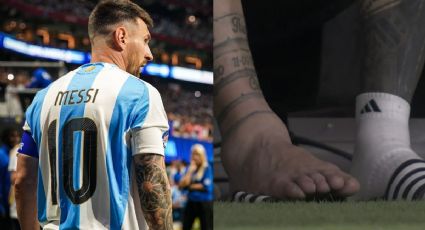 Expertos revelan gravedad de la lesión de Messi y cuánto tiempo será baja tras ganar Copa América