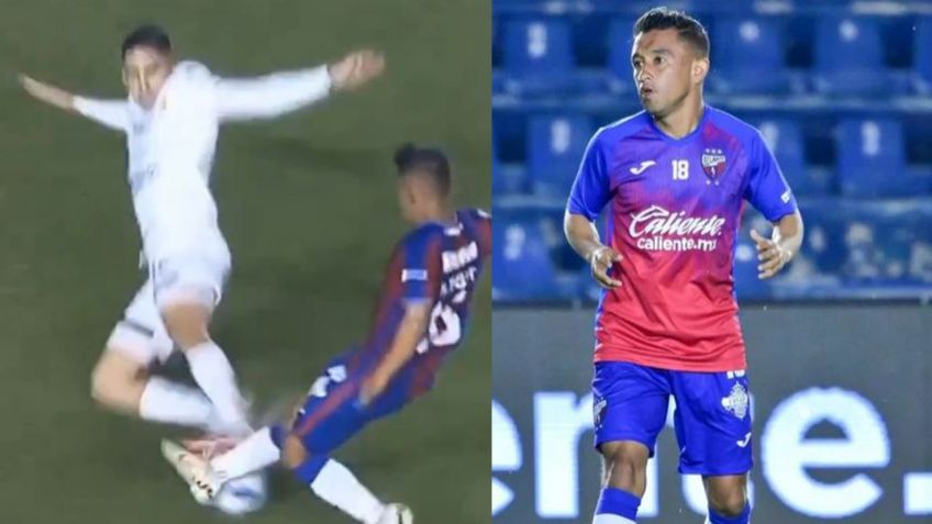 Así fue la terrible FRACTURA que sufrió Hobbit Bermúdez tras barrida criminal de Luis Ruiz | VIDEO