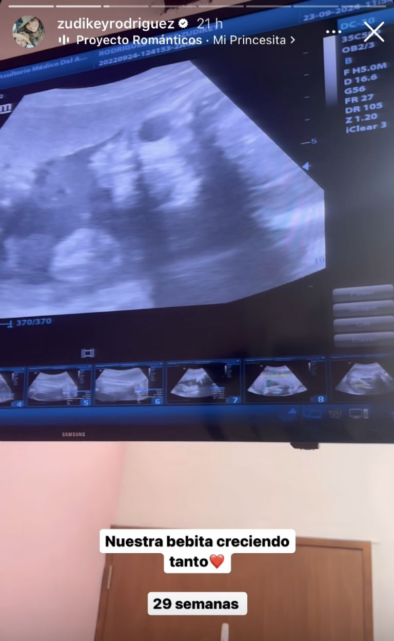 IG: @zudikeyrodriguez