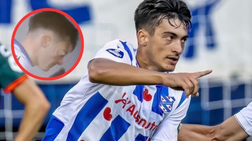 Jugador en Europa sufre extraña lesión en pleno partido: se le salió el ojo de su órbita | VIDEO
