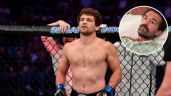 Foto ilustrativa de la nota titulada: Ben Askren, el expeleador de UFC que "murió 4 veces" durante su doble trasplante de pulmón