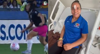 Charlyn Corral reaparece tras operación por lesión en el Duelo de Estrellas: "pronto volveré"