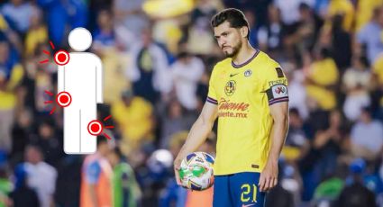 Henry Martín: su historial de lesiones desde 2024 y cómo han afectado al América
