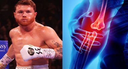 Aseguran que Canelo Álvarez tuvo una cirugía de codo, ¿cuándo volvería al boxeo?