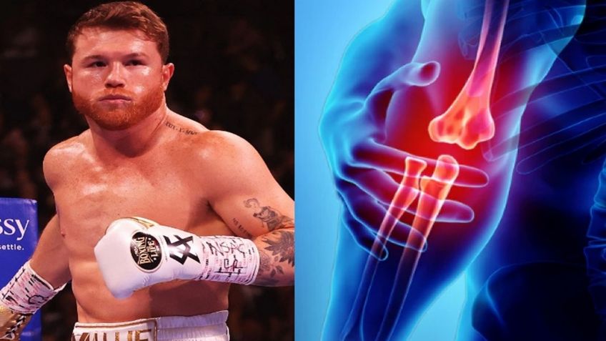 Aseguran que Canelo Álvarez tuvo una cirugía de codo, ¿cuándo volvería al boxeo?